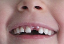 Stolz